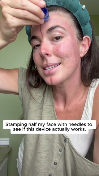 Why I stabbed half my face with needles!!