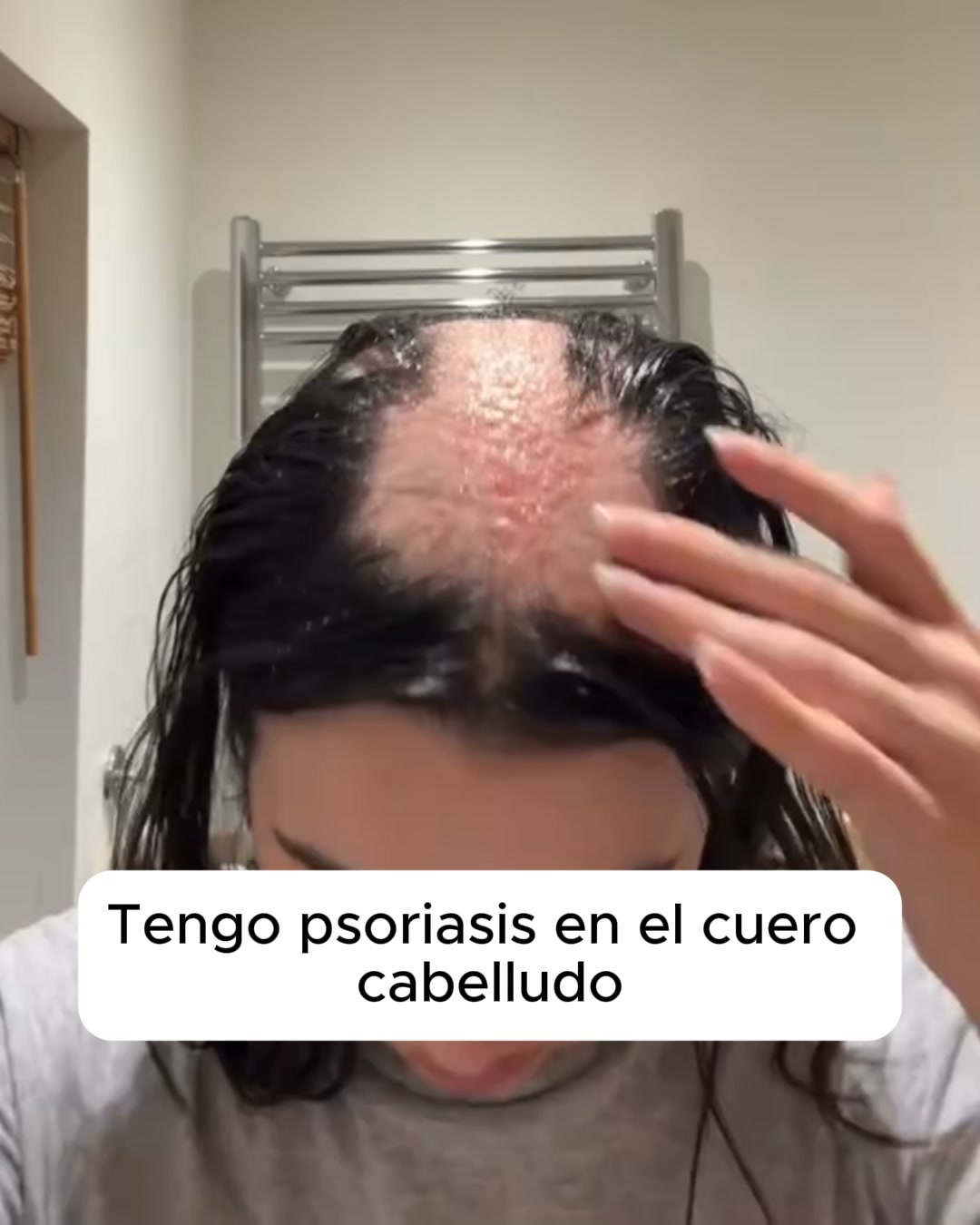 El bálsamo natural que frena el picor de raíz.