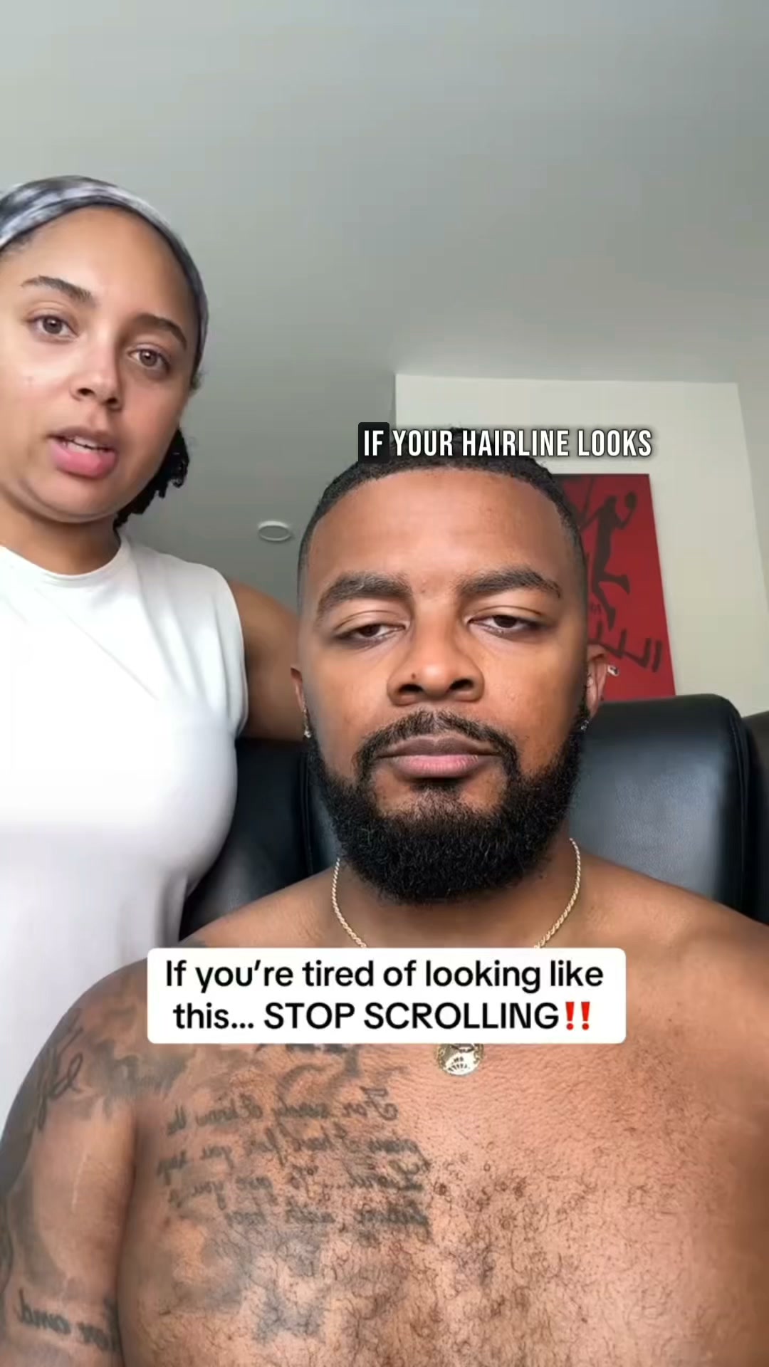 Bring back Your Hairline Naturally