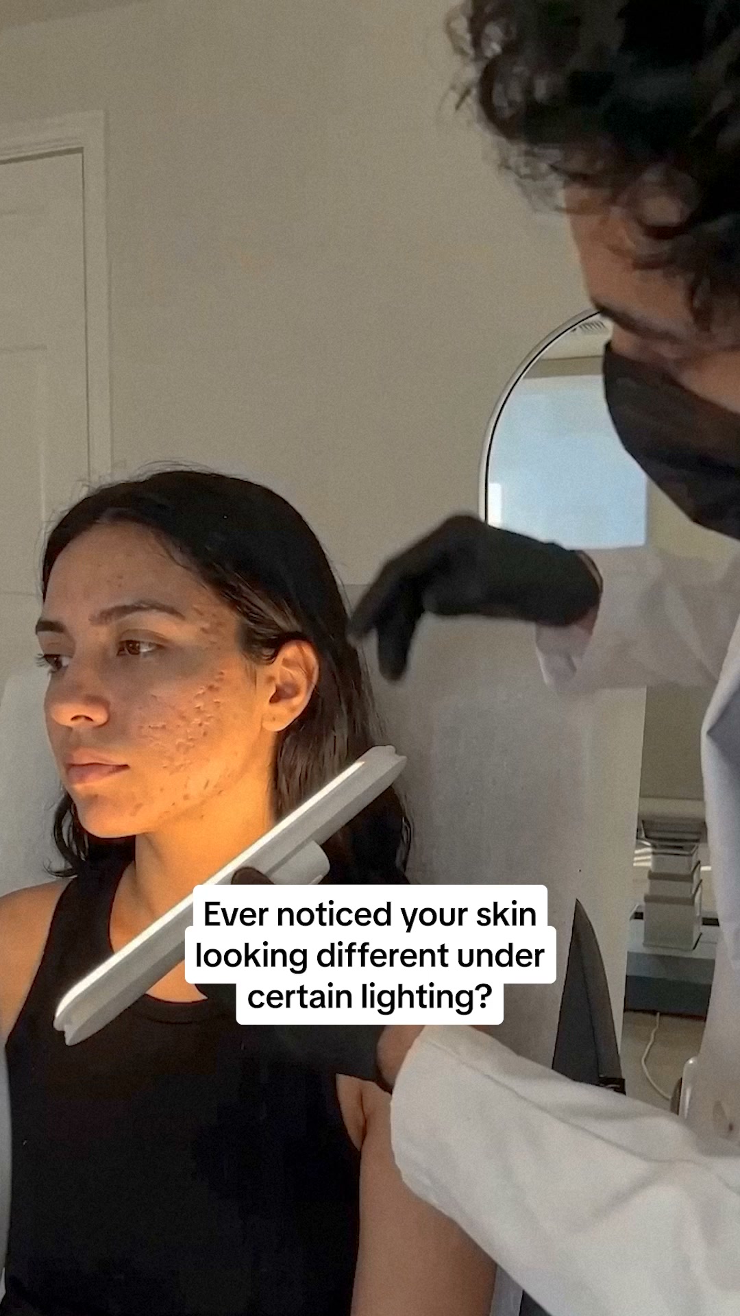 PDRN Heals Acne Scars