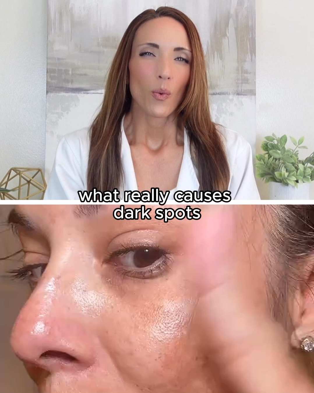 The Crepey Skin Myth: The Real Reason Contributing to Aging Skin