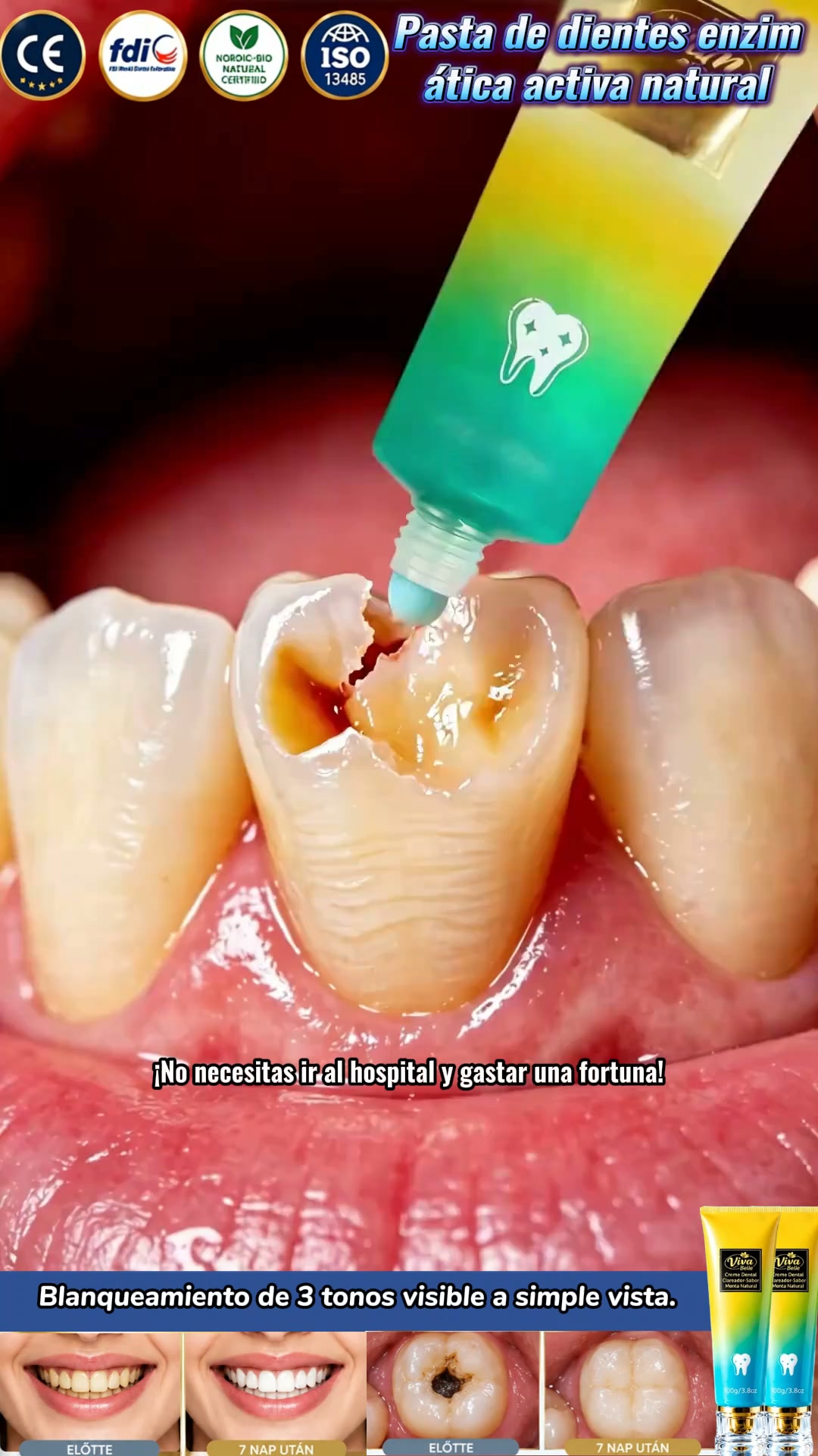 Suero de nanohidroxiapatita para el cuidado dental diario.