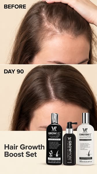 Hair Growth Shampoo, Conditioner & Scalp Elixir Set - The Complete 3-Step Routine | Most Purchased