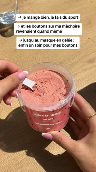 SOPK : 91 % ont vu leurs boutons réduits en 4 semaines. Sans toucher aux hormones.