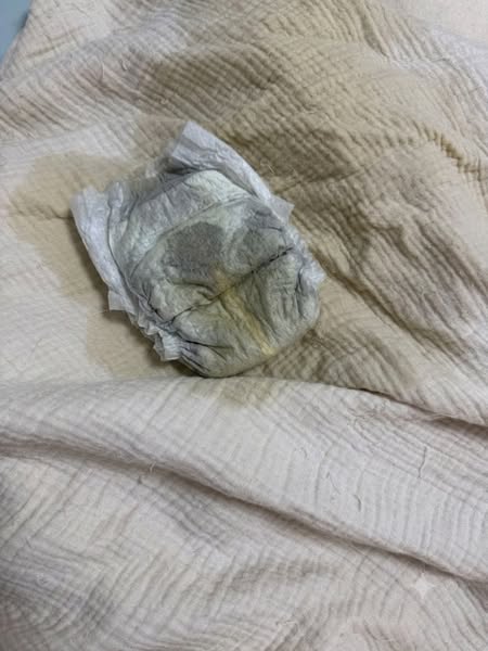 My 9yr old still wets the bed