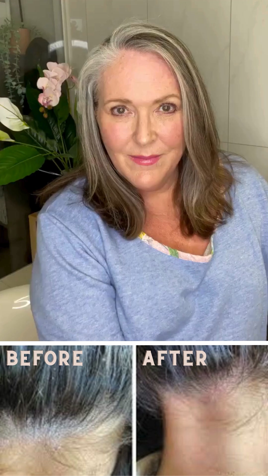Nurture Your Scalp, Embrace Life