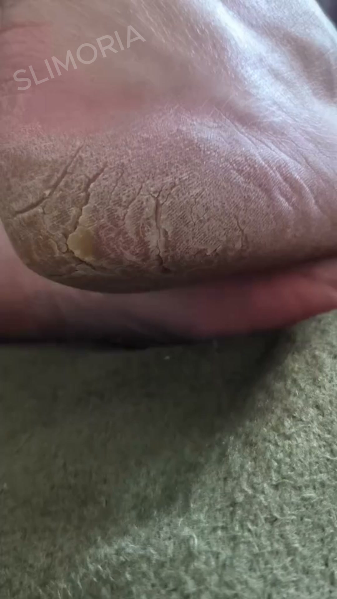 Softer, Smoother Feet in Minutes