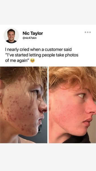 A skin treatment that actually works