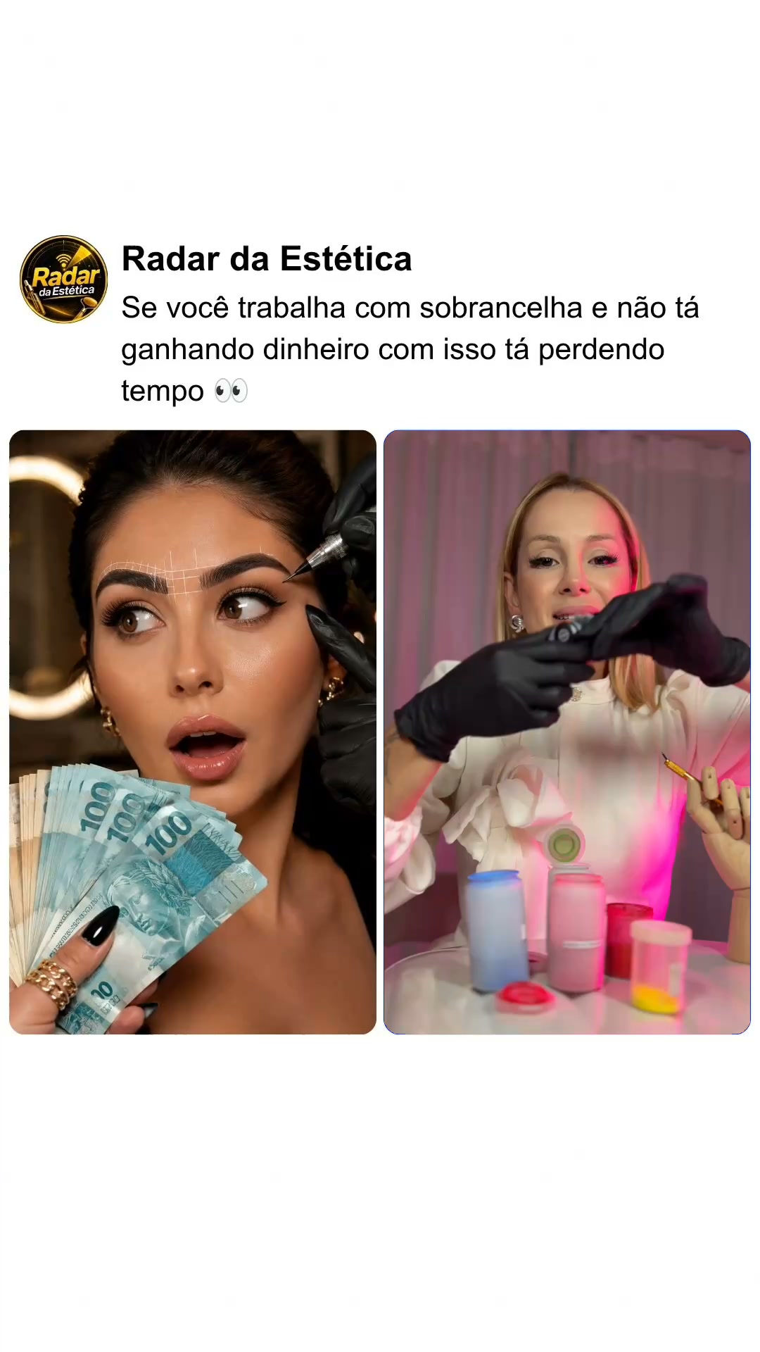 Exclusividade na estética