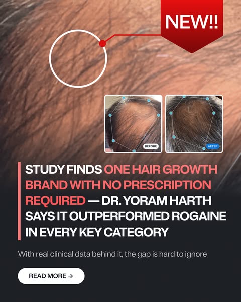 Best Hair Growth Products of 2026