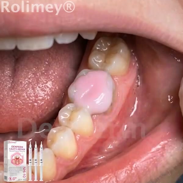 Réparation des Caries 10 % Nano-Hydroxyapatite (NH-10) reconnu par la FDA | Livraison sous 2 à 4 jours ouvrés | Garantie de remboursement