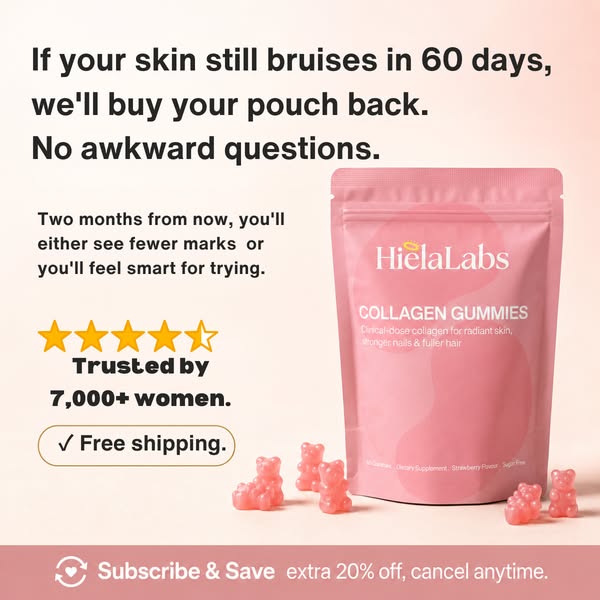 Read this if you wake up to bruises you cannot explain