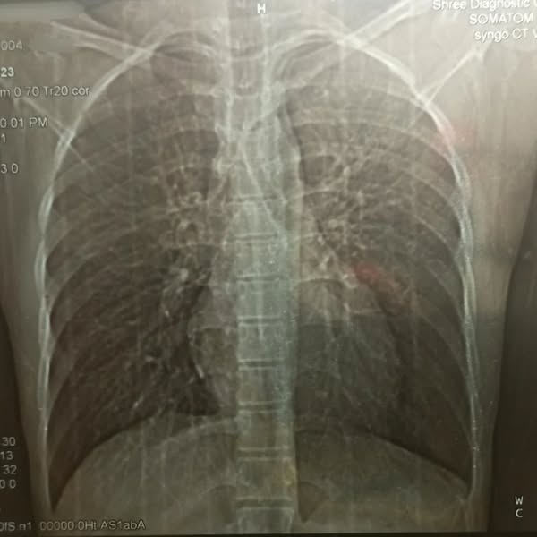 Your COPD Isn’t Just A Lung Problem