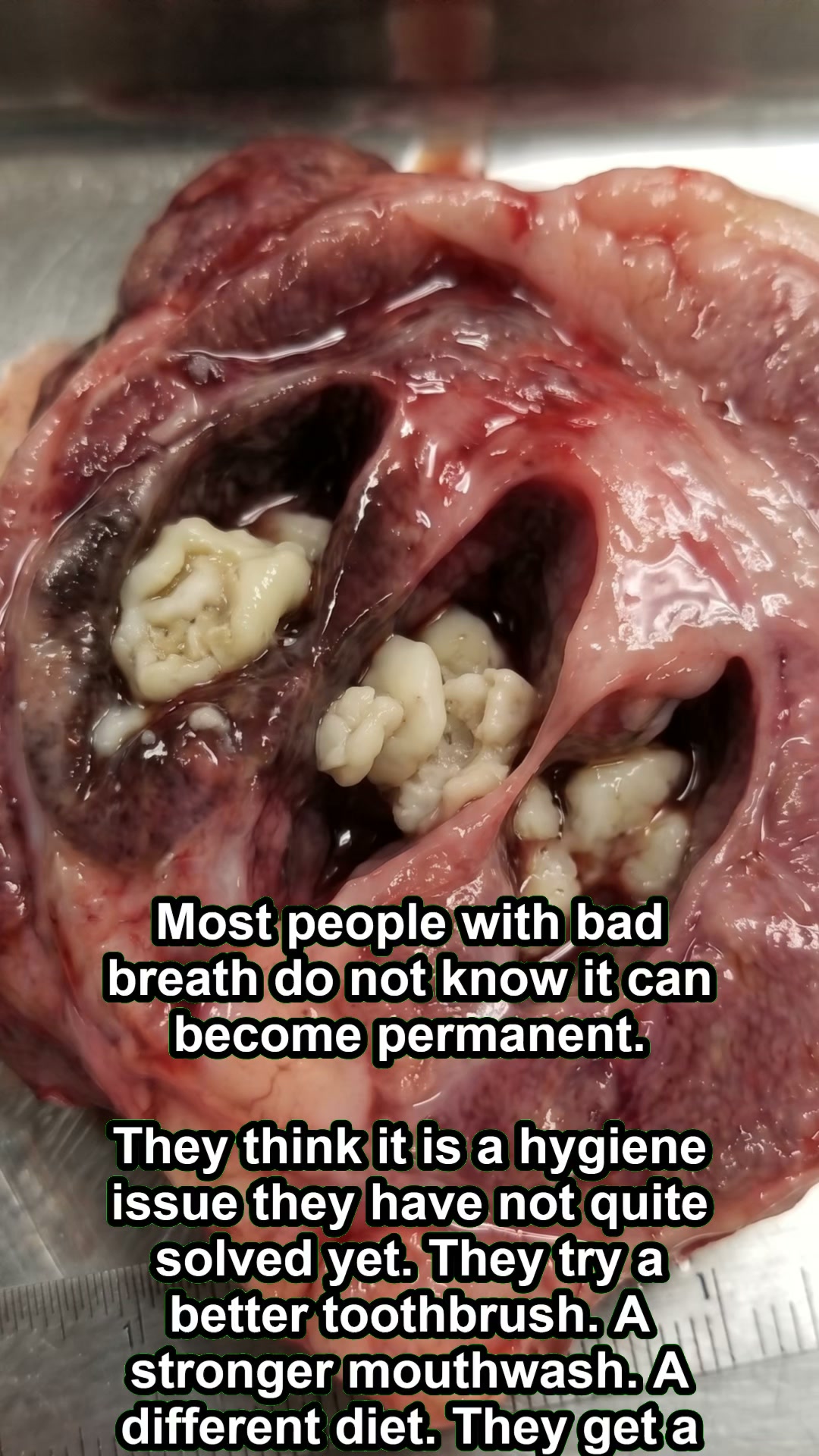 To people who have great hygiene and still can't get rid of bad breath — here's why nothing has worked.