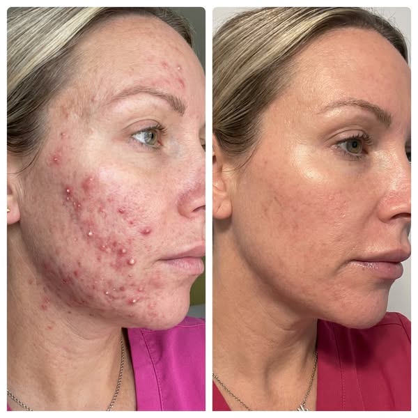 Turns out my skin was never the problem