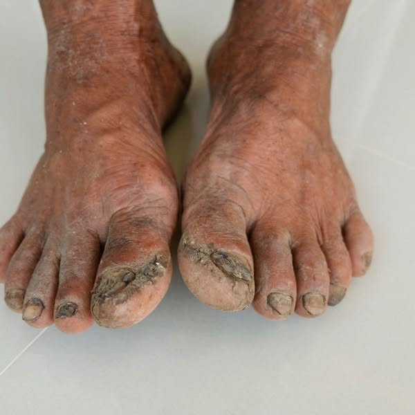 I Fit Artificial Limbs for a Living.