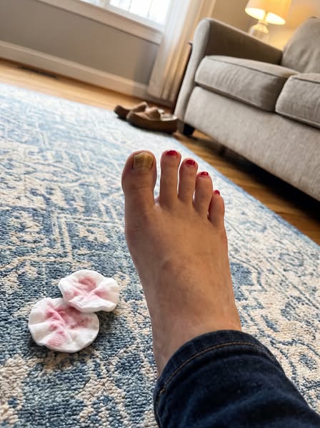 Read this if you have toe fungus