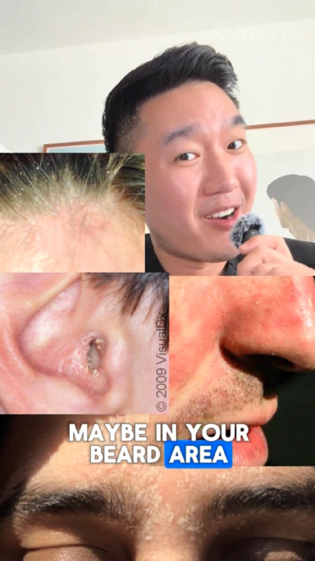 Still itching? It's not dry skin — it's fungus living on your face