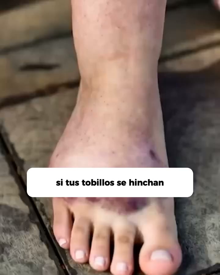 +20.000 Vendidos en toda España