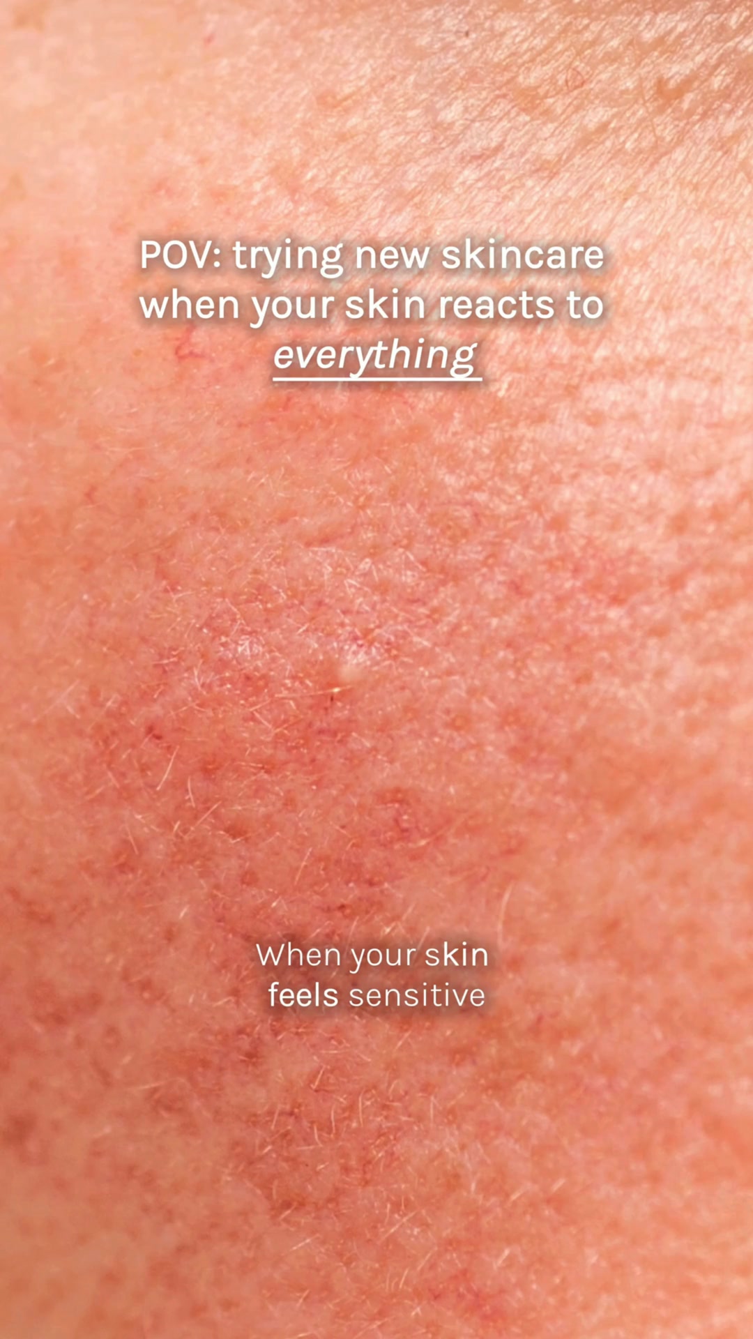 Your daily shield for sensitive skin.