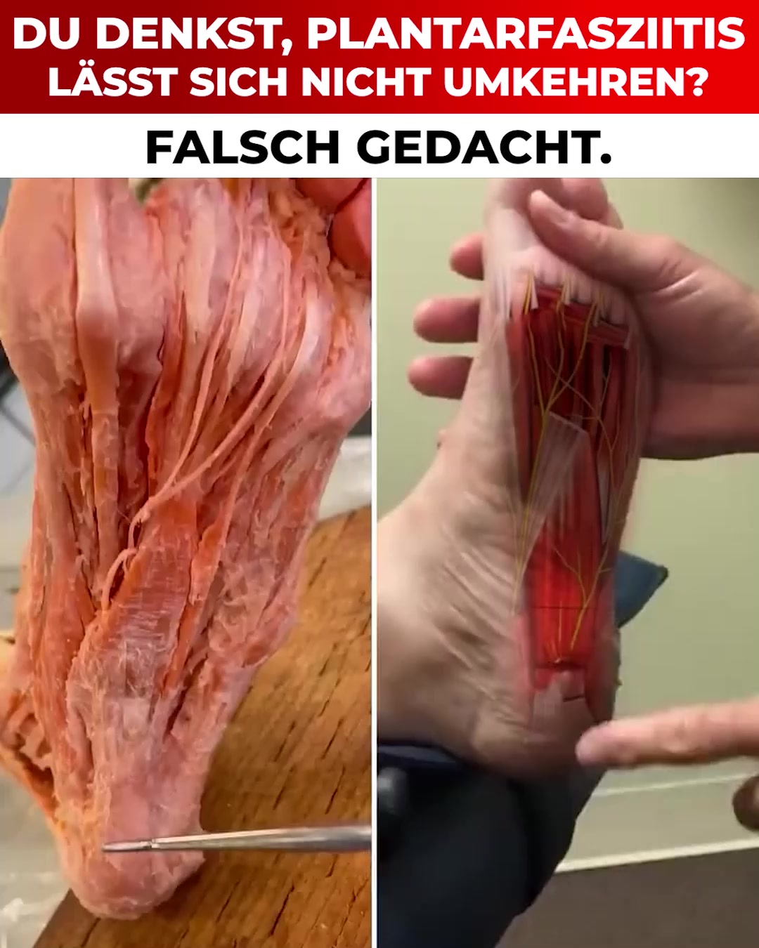 Schmerzfrei Gehen mit ComfySole