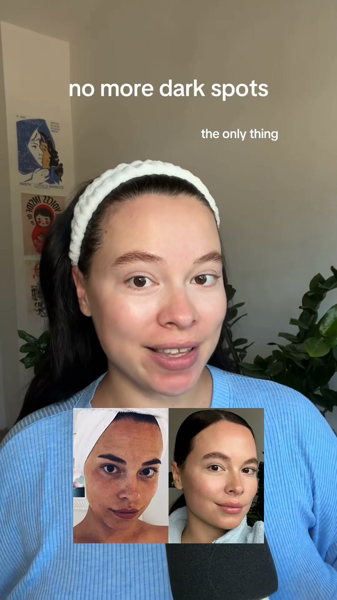 3 Weeks to Noticeably Fewer Dark Spots