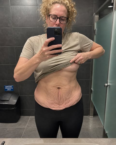 Dermatoloog Zei Dat Er Niets Aan Te Doen Was. Ze Had Het Mis.