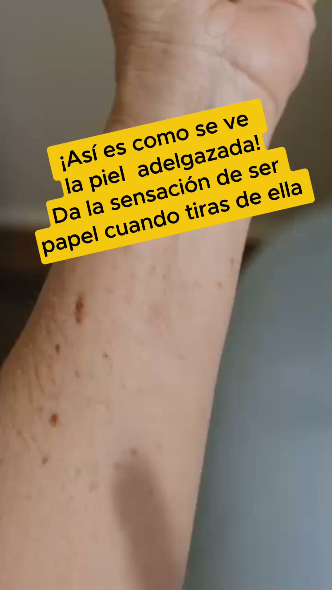 Aceite corporal Elixir: para piel extremadamente fina