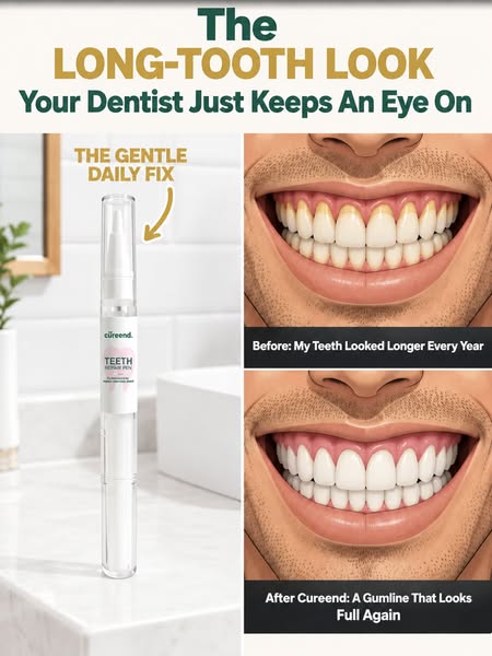 My Gums Kept Pulling Back