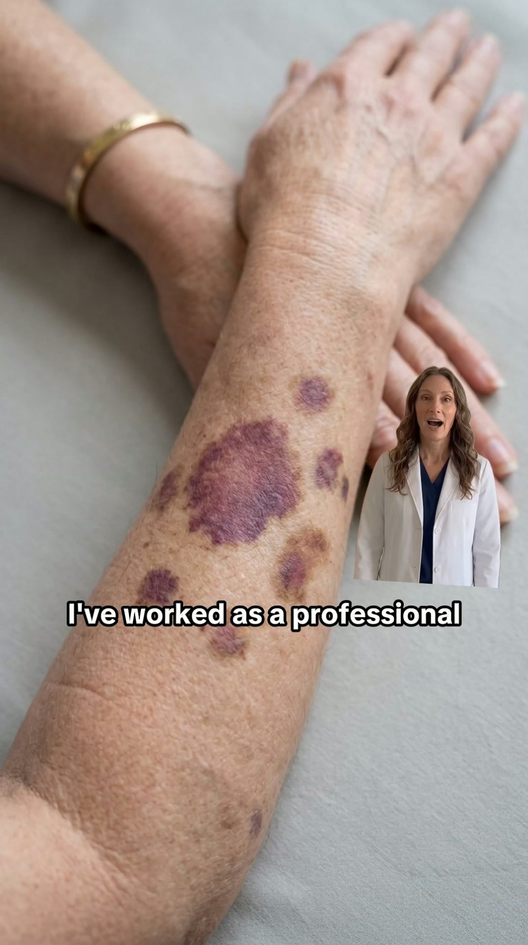 Bruises Gone In Days