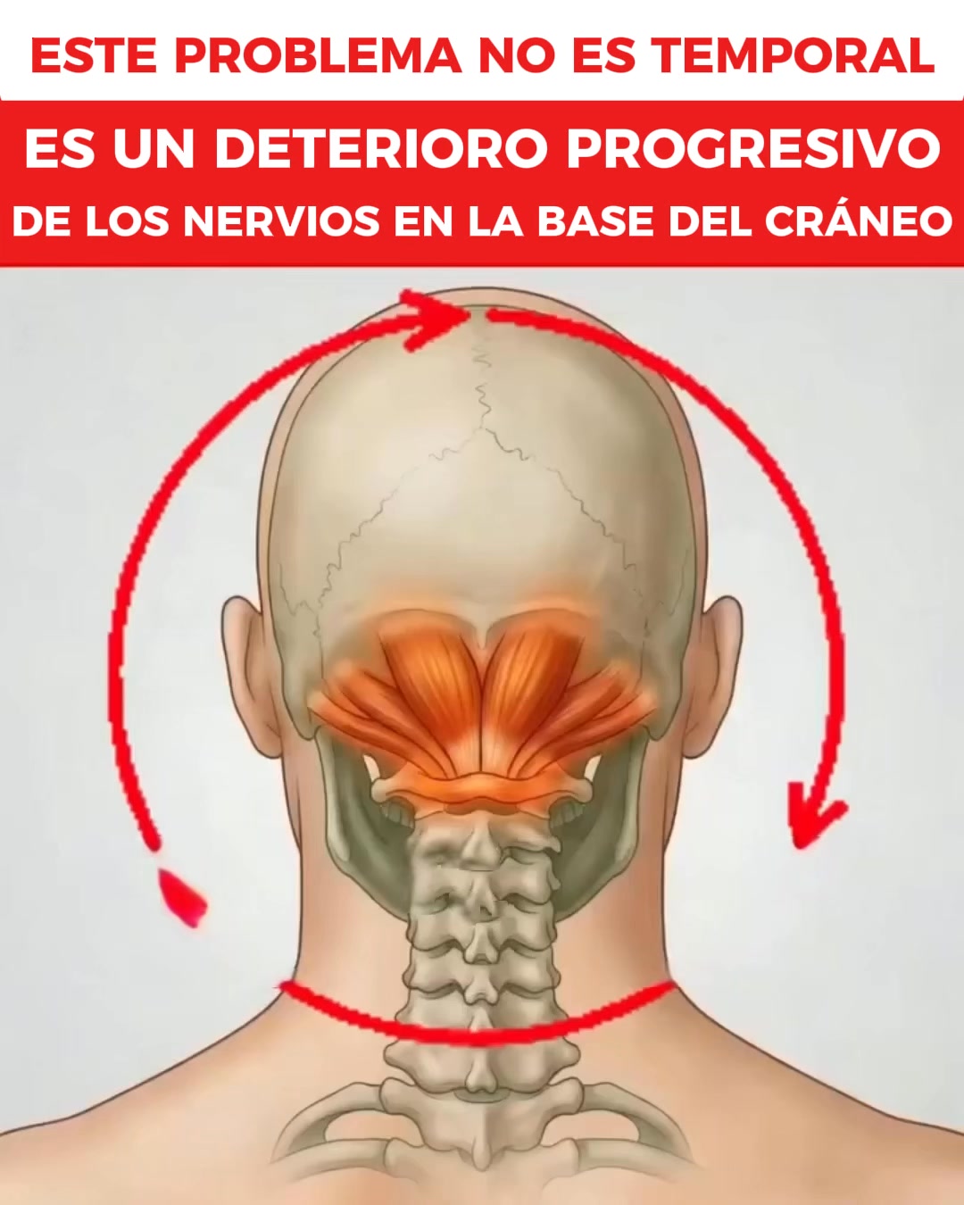 Empieza Leve, Luego Empeora