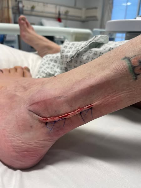 After Years of Pain, Even My Husband Couldn't Believe