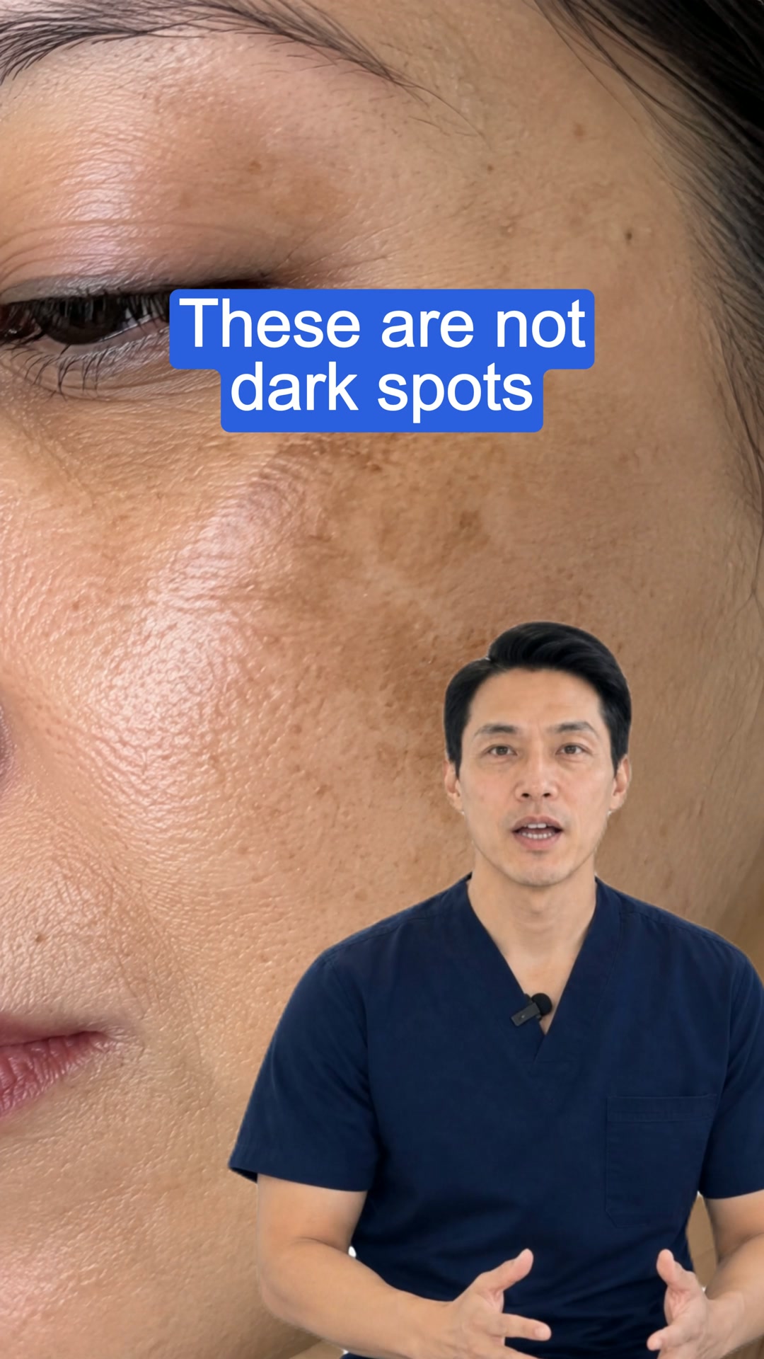 Melasma Care: 50% Off + Free Brightening Brush
