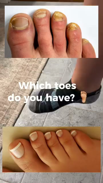 The Real Reason You’re Hiding Feet