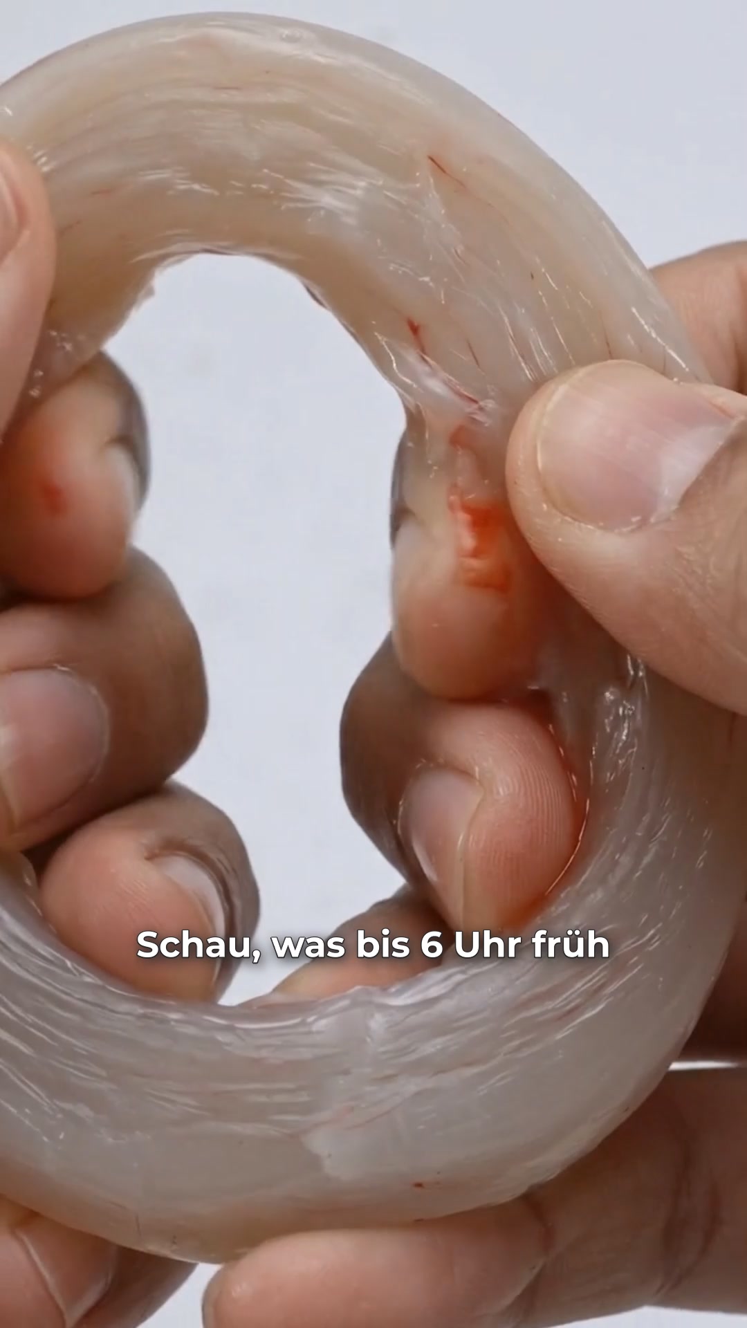 Bewegungsfreiheit zurück