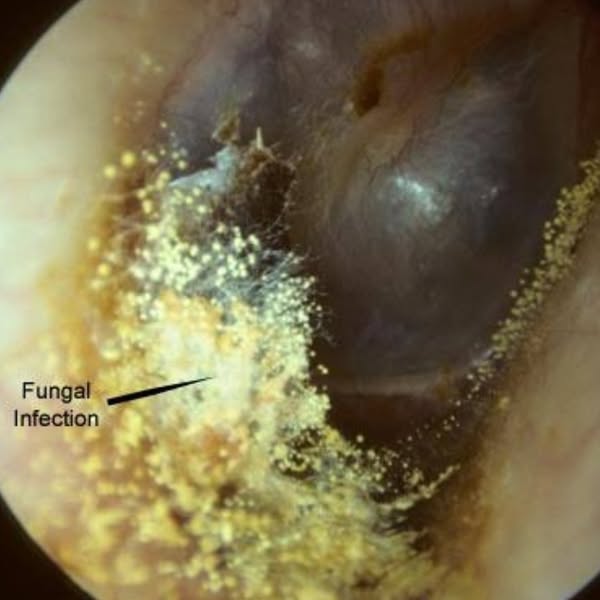 There is something growing in your ear...