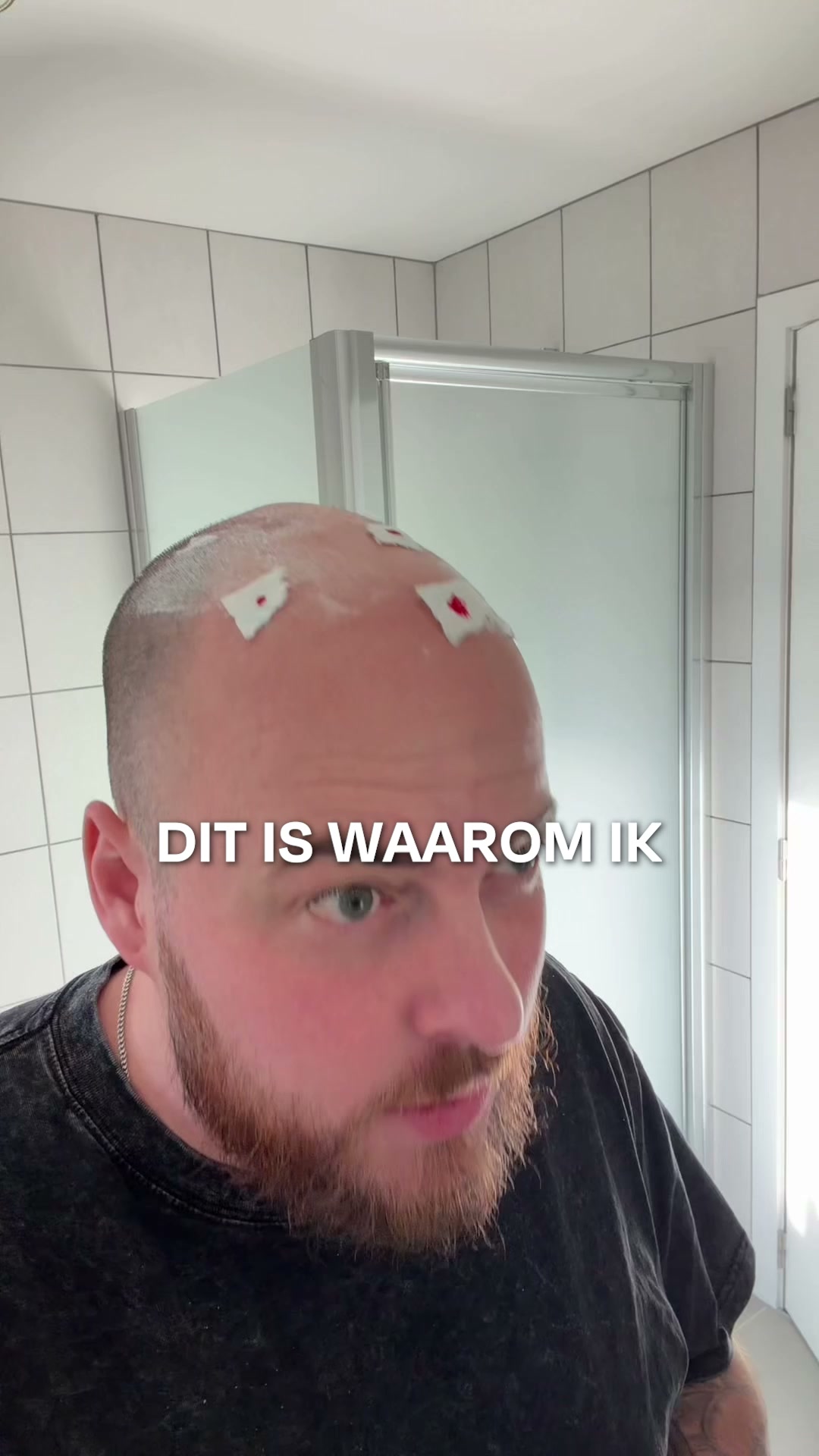 15% extra korting | CODE: VECHTERSBAZEN15
