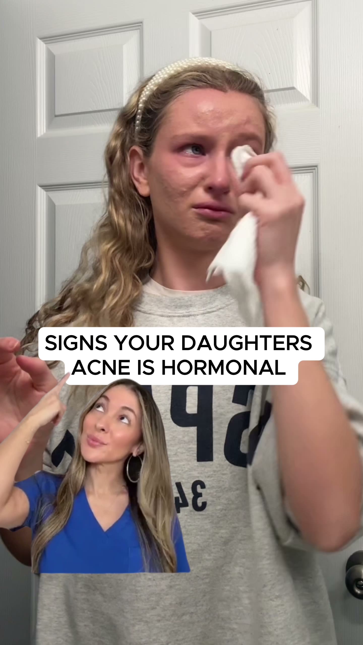 No ACNE or Money Back