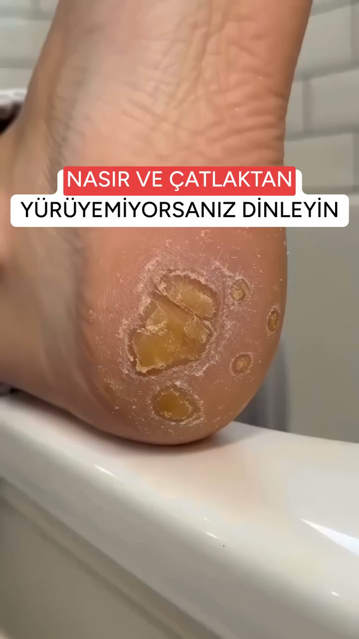 KUP 1, DRUGI GRATIS! DARMOWA DOSTAWA!