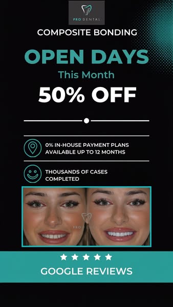 Up to 50% Composite Bonding and Veneers