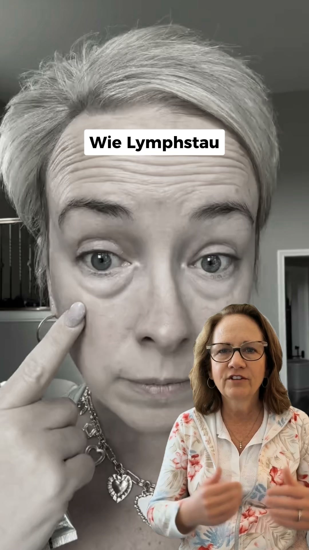 Geschwollene Augen lösen