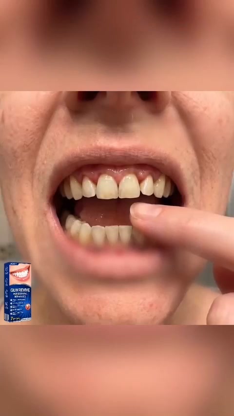 Focused Nighttime Care for the Gumline