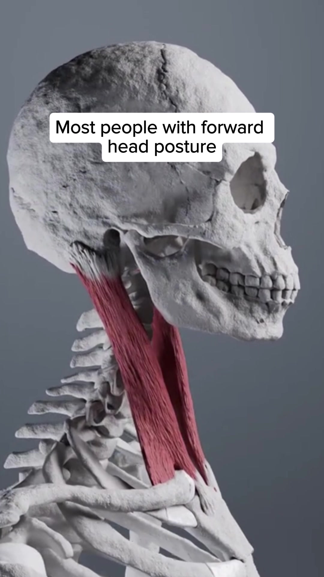 No More Neck Pain | 1000+ Happy Sleepers