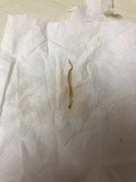 Oregano oil + Black seed oil