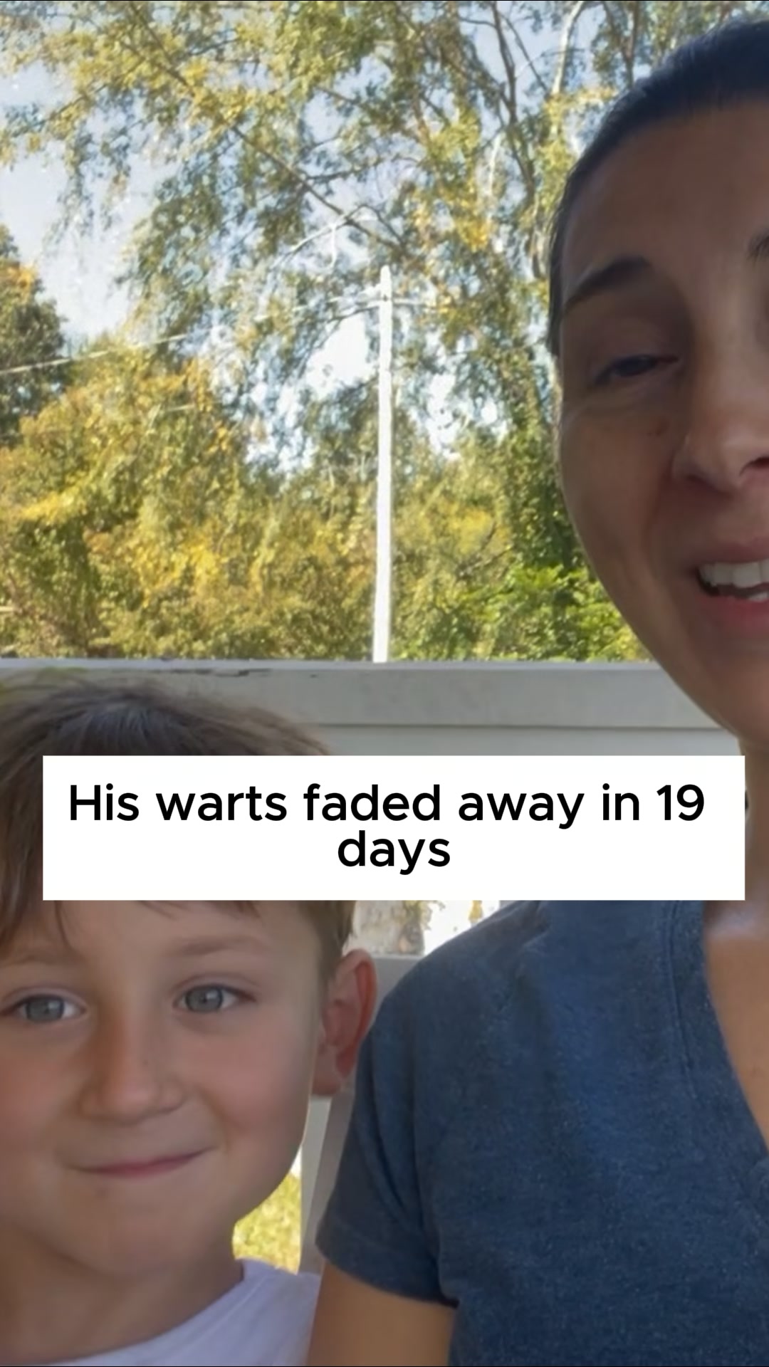 A Natural Choice For Warts