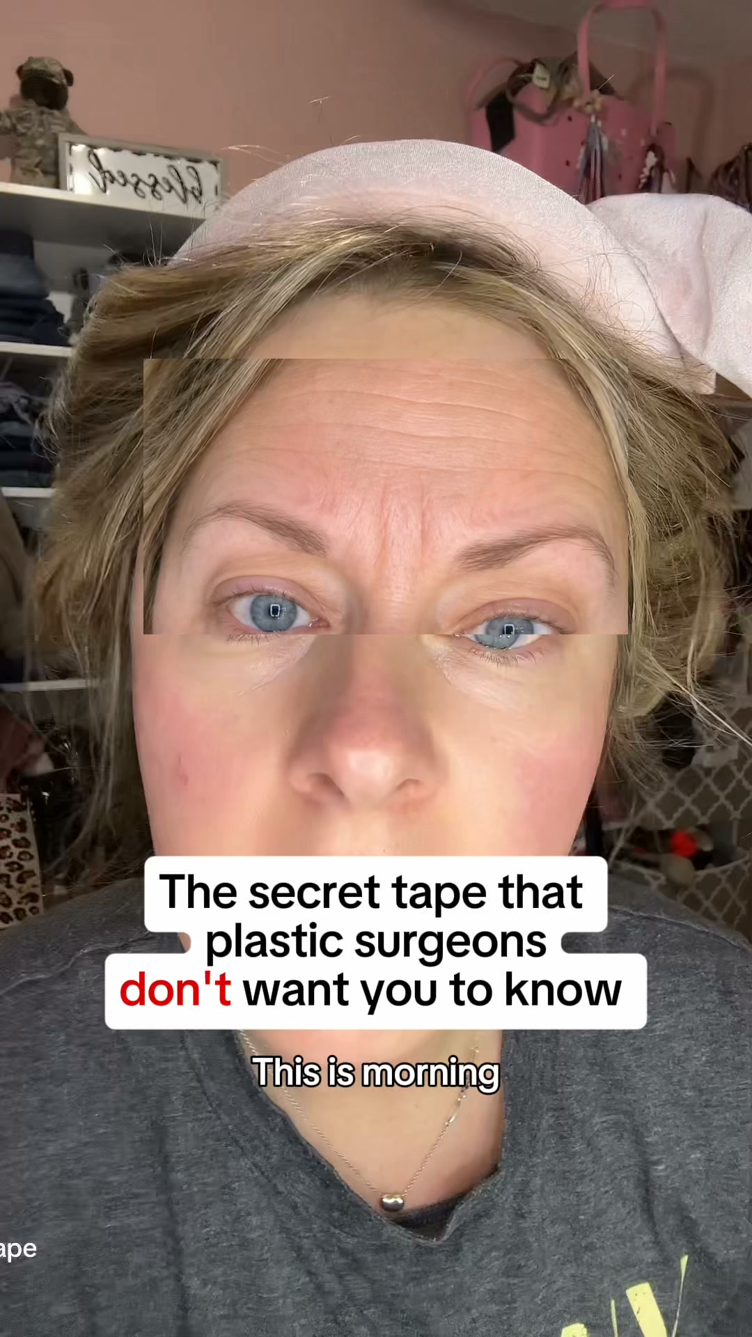 Celebrate Mom: 60% OFF Scarlette Collagen Tape (Limited Time)!