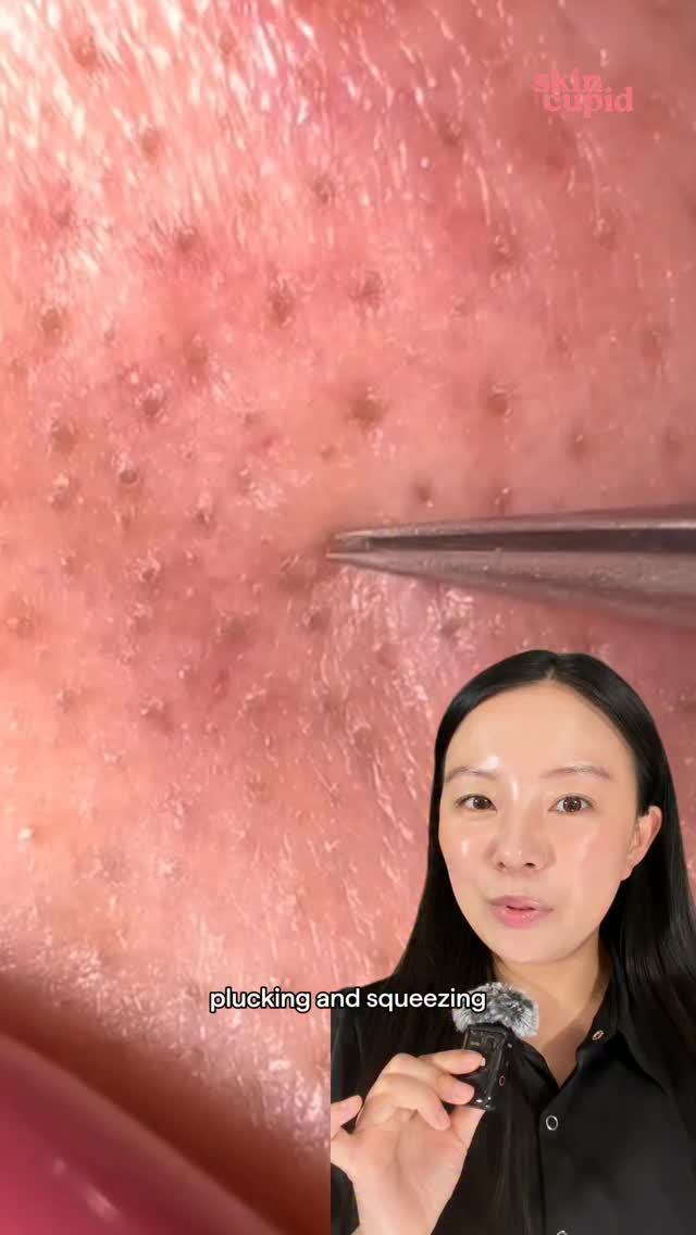 Anúncio de Skin Cupid - Your Korean Skincare Guru