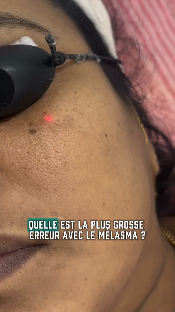 Micro-Infusion : une seconde jeunesse pour votre peau