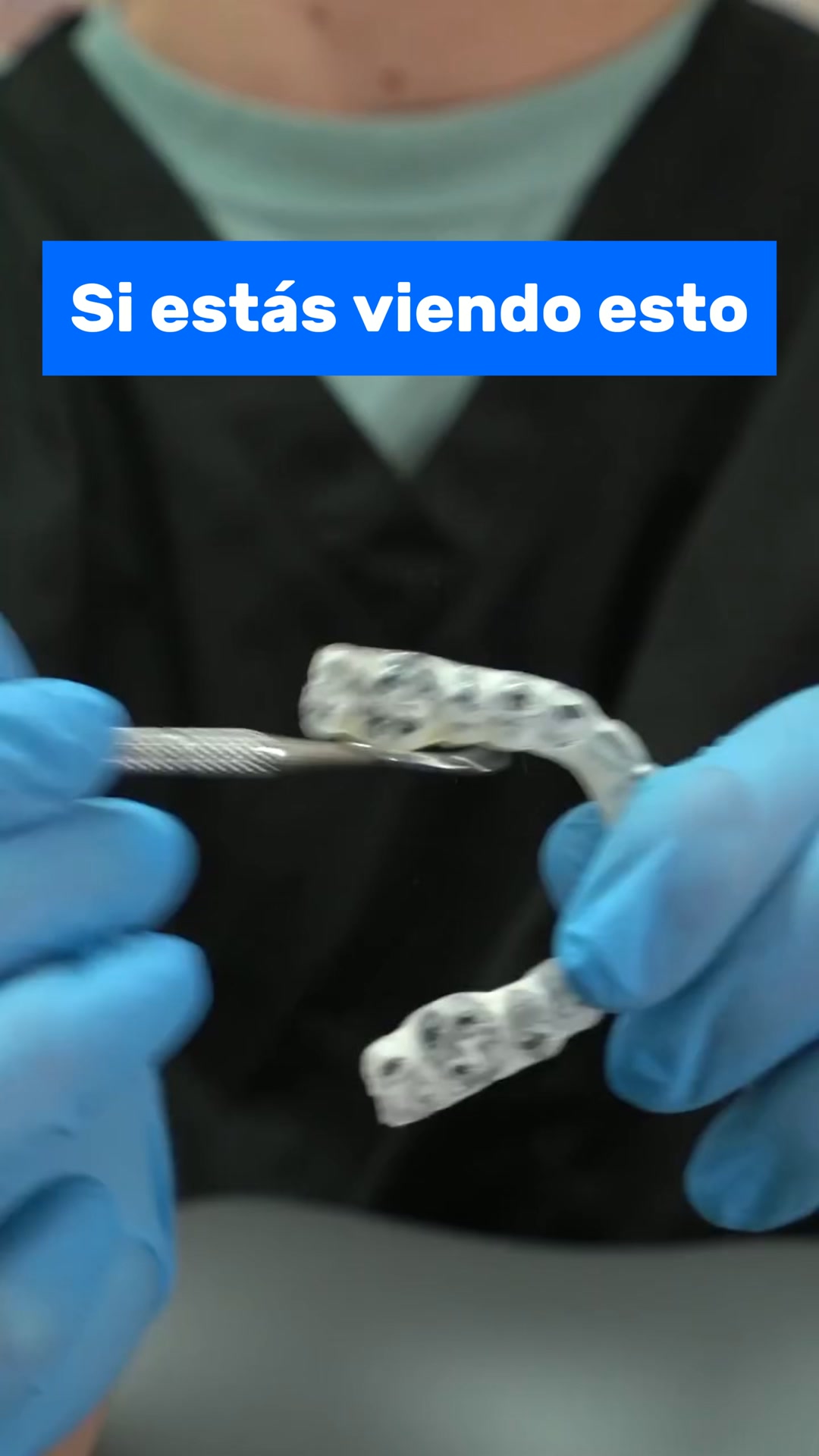 Limpieza Ultrasónica en 5 min
