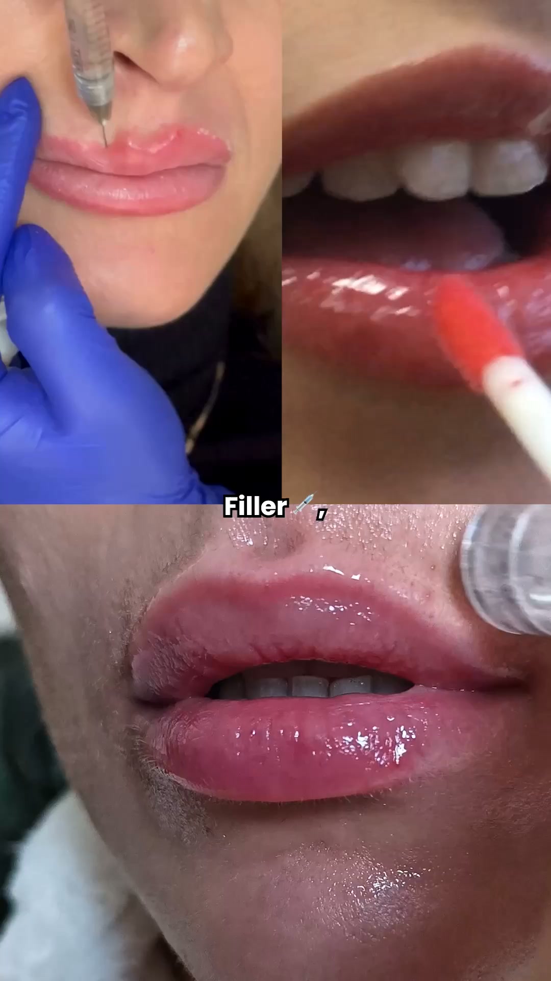 Labbra più piene? Prova questo